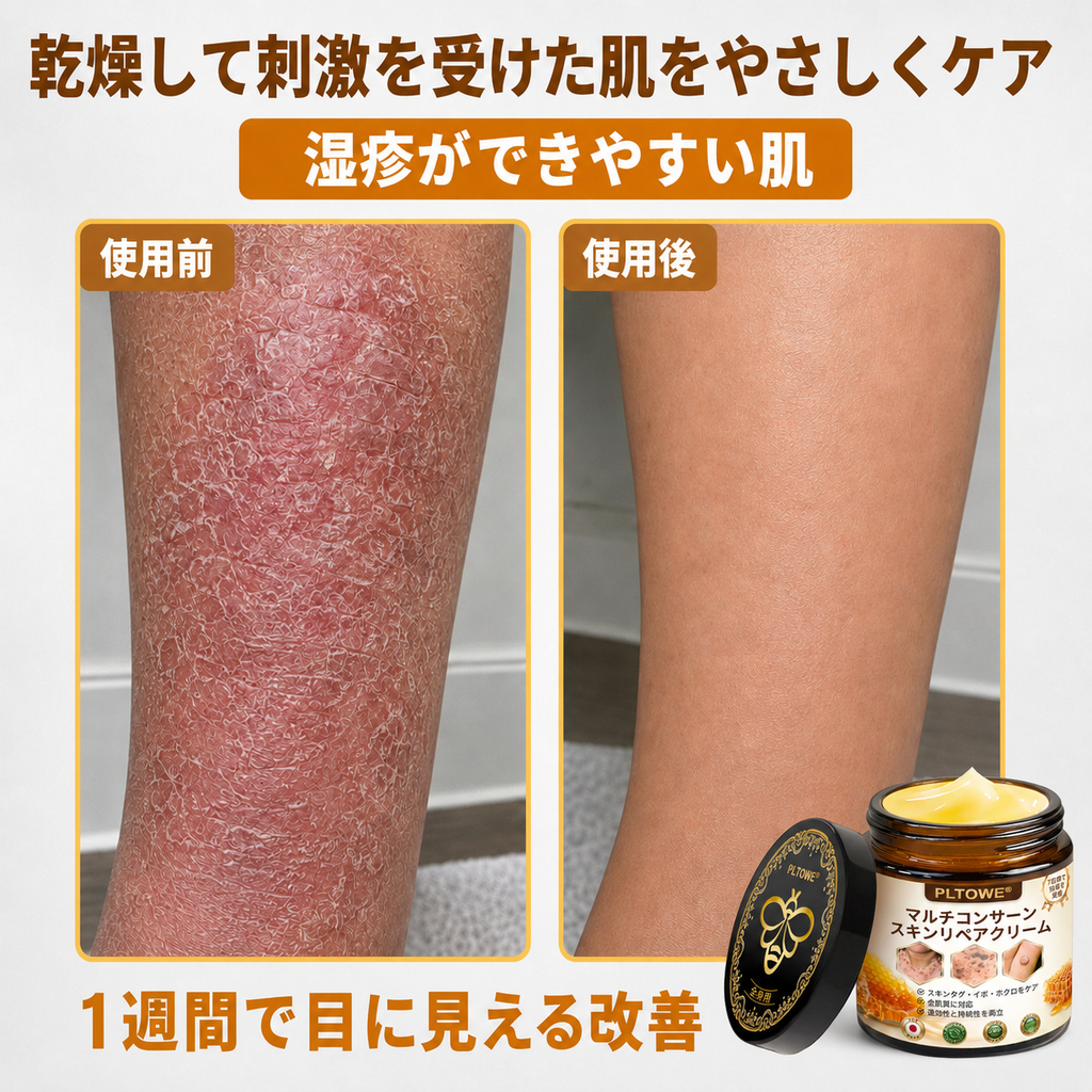 🔥 PLTOWE® マルチスキンリペアクリーム  1本で、肌荒れ・乾燥・エイジングサイン・くすみ・肌ダメージをトータルケア。