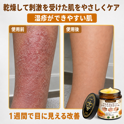 🔥 PLTOWE® マルチスキンリペアクリーム  1本で、肌荒れ・乾燥・エイジングサイン・くすみ・肌ダメージをトータルケア。