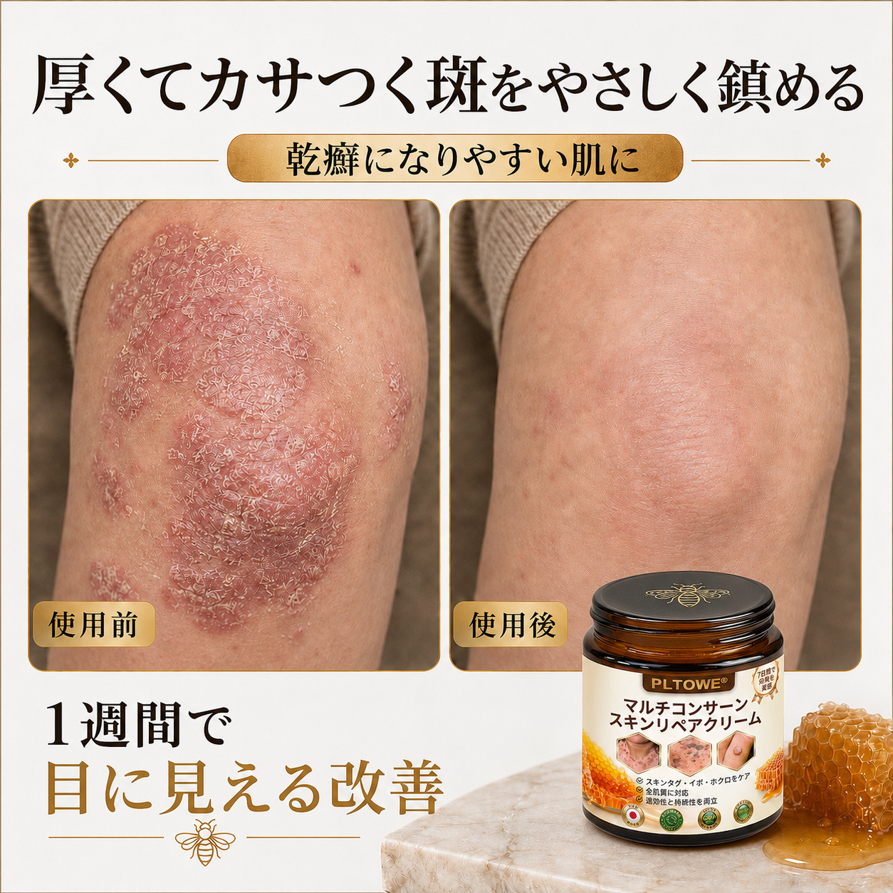 🔥 PLTOWE® マルチスキンリペアクリーム  1本で、肌荒れ・乾燥・エイジングサイン・くすみ・肌ダメージをトータルケア。